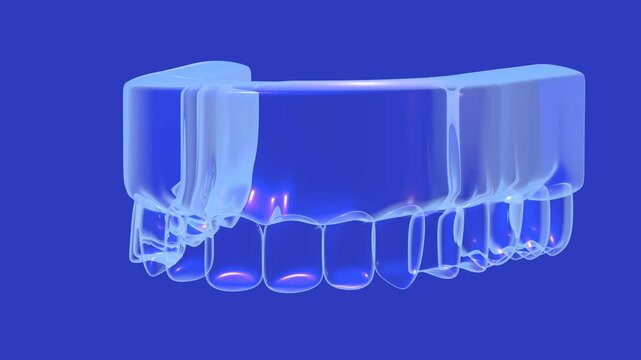 3D animation of a denture with a rotating transparent glass gum. Showing the anatomical interior with lights on a blue background.