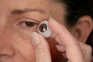 Ocularist preparing custom ocular prosthesis for patient