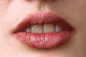 Woman biting her lip showing white teeth