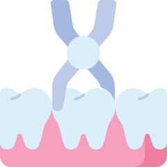 Tooth Extraction Illustration