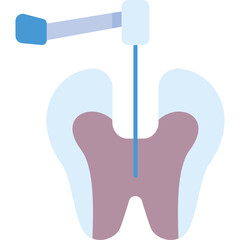 Tooth Canal Cleaning Illustration