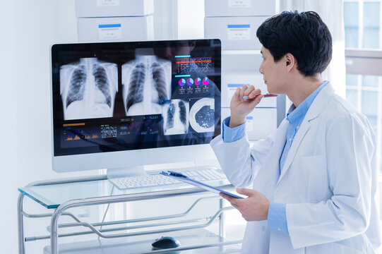 A young male doctor in a white lab coat is deeply focused while reviewing a patient's chest X-ray and analytical graphs displayed on a computer monitor. He is holding a blue clipboard and a pen, worki