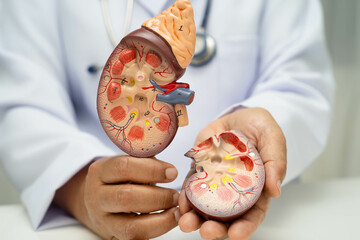 Chronic kidney disease, doctor with model for treatment urinary system, urology, Estimated...