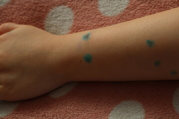 a child's hand with spots of green