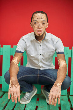 Young man with vitiligo on a green bench in front of a red wall