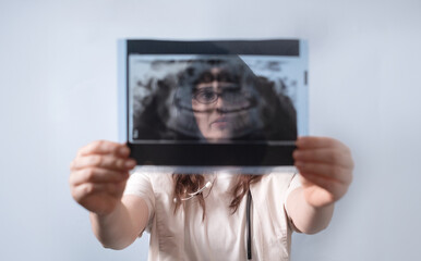 The doctor examines the patient's X-ray to choose an individualized approach for dental treatment.