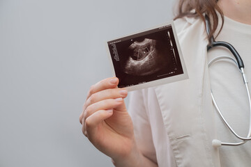 Female obstetrician holds ultrasound image, advising on reproductive health and family planning.