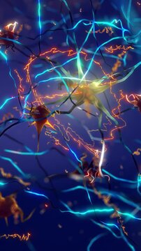 Alzheimer's disease is the most common cause of dementia. It's a neurodegenerative brain disease caused by the progressive loss of neurons. Amyloid plaques forming between neurons, vertical video. 