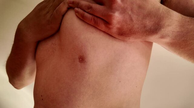 A man with a birth defect in his chest