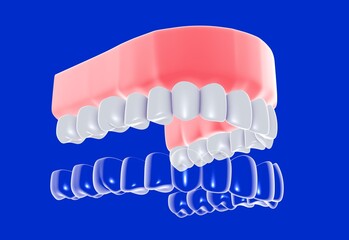 3D illustration of a dental cap in a transparent glass graphic style. Before placing it on a gum with a realistic denture. On a blue background.