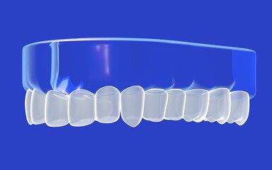 3D illustration of a denture with a transparent glass gum. With white teeth. Showing the interior on a blue background.