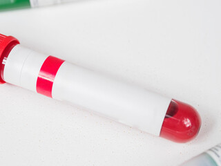 A close-up of a blood collection container, ready for medical testing. Sterile and professional.