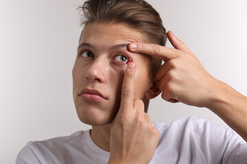Man putting color contact lens in his eye on light background