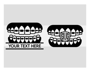 Fake Braces, Fake Braces Kit, Fake Braces Clip On, Braces Svg, Dental Braces For Kids, Braces Clipart, Teeth Svg, Braces Silhouette, Dentist, Dental Hygienist, Braces Outline, Eps, Cut file