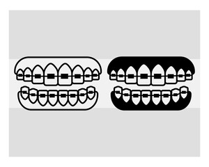 Fake Braces, Fake Braces Kit, Fake Braces Clip On, Braces Svg, Dental Braces For Kids, Braces Clipart, Teeth Svg, Braces Silhouette, Dentist, Dental Hygienist, Braces Outline, Eps, Cut file