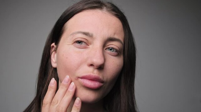 Close-up of a woman's lips with a visible cold sore touching her face, showing skin texture and natural imperfections. Female lip ulcers herpes.