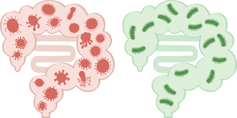 A vector illustration comparing a healthy intestine with beneficial bacteria and an unhealthy intestine with harmful bacteria, highlighting the importance of gut microbiome balance