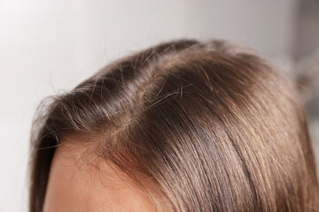 Woman with healthy hair roots on blurred background, closeup