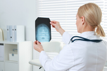 Doctor examining x-ray image of paranasal sinuses in clinic, space for text