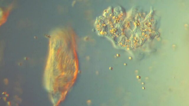 Rotifers and Amoeba in freshwater-400x DIC microscope differential interference microscopic observation pond microorganisms protozoa
