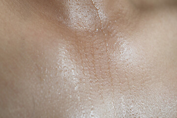 Close-up of glistening skin showing sweat and natural texture
