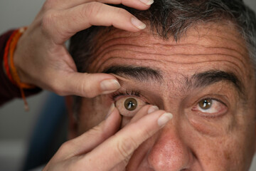 Ocularist placing prosthetic eye in patient's socket