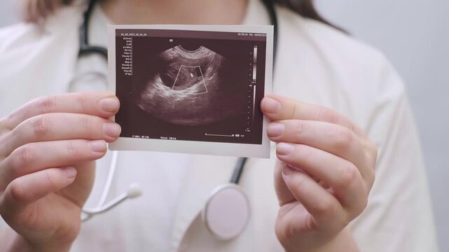 Obstetrician and gynecologist shows ultrasound results to women seeking motherhood through IVF.