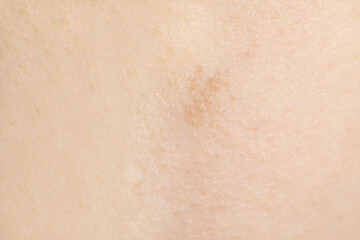Texture of healthy skin as background, closeup