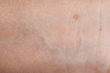 Fototapeta premium Macro view of dry skin as background