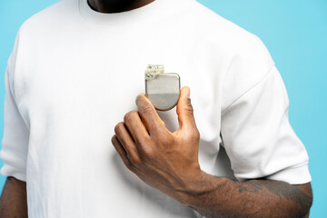 Patient showing pacemaker device implanted in chest closeup