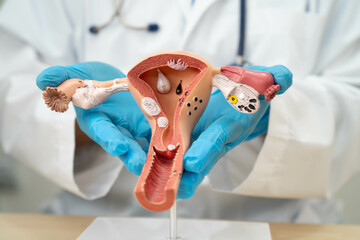 Uterus, Asian, woman holding human anatomy model.
