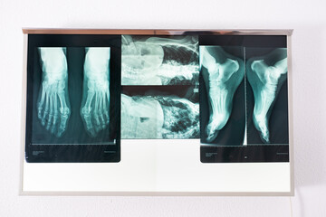 General view of a Viewing Box of radiographs of the consultation of a doctor with many radiographies of different body parts and patients. Health care, medicine and technology