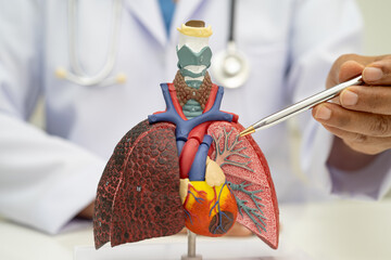 Pneumonia, lung cancer, Asian doctor holding human anatomy model for study diagnosis and treatment...