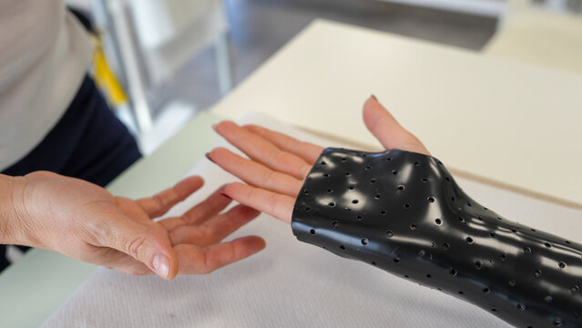 Medical therapist adjusting a hand splint for a girl in a rehabilitation clinic