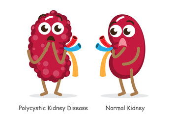 Polycystic Kidney Disease and normal kidney . Cute funny medical cartoon character . Isolated white background . Vector .