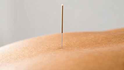 Acupuncture Needle Inserted into Human Skin for Alternative Medicine Therapy