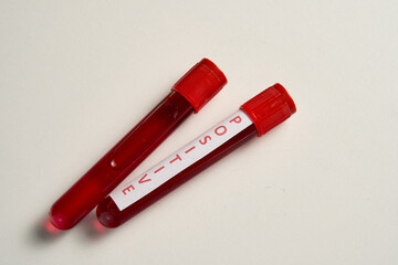 Two red blood tubes with the word positive written on them. The tubes are placed on a white surface