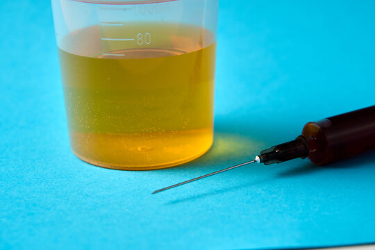 A syringe is next to a cup of liquid. The syringe is red and the cup is yellow