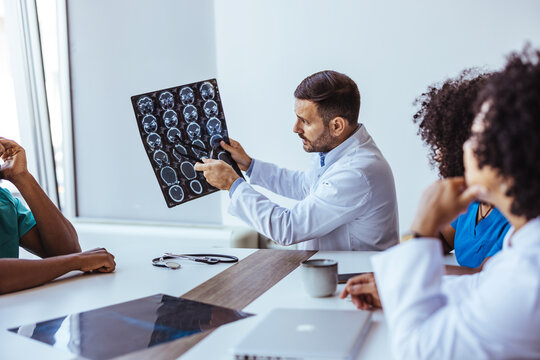 Doctors Collaborating During a Medical Discussion Reviewing Brain Imaging Results