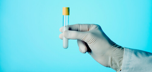 man with a test tube with semen, web banner