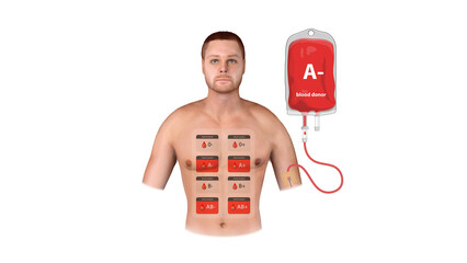 A medical infographic displaying A Negative blood donation, transfusion process, and compatibility with different recipient blood types, 3d
