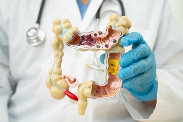 Intestine, doctor holding human anatomy model for study diagnosis and treatment in hospital.