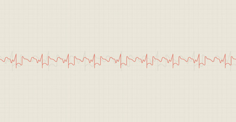 Naklejka premium Electrocardiography heartbeat line monitor. Ecg