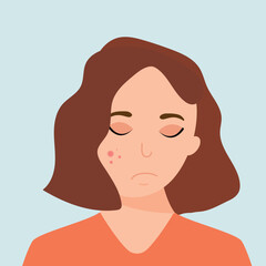 Young girl has skin problems with acne or allergic pimples on her face. Skincare and dermatology concept. Flat style vector illustration.