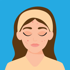 Young girl has skin problems with acne or allergic pimples on her face. Skincare and dermatology concept. Flat style vector illustration.