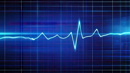 EKG or ECG heart rhythm graph
