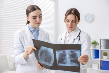 Doctors examining x-ray of lungs in hospital