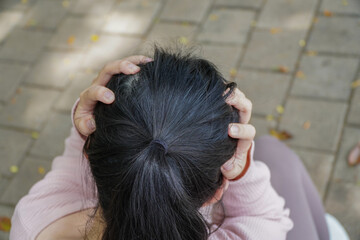 Naklejka premium Close Up of a Woman with Dandruff in Dark Hair Holding Head Outdoors Underneath Tree and Pale Pink Sweater