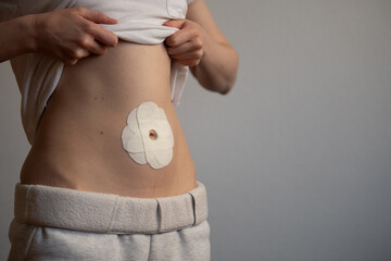 A person is lifting their shirt to reveal a medical adhesive patch positioned on their abdomen. The...