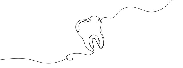 Continuous line, molar, one tooth vector illustration with transparent background editable stroke.